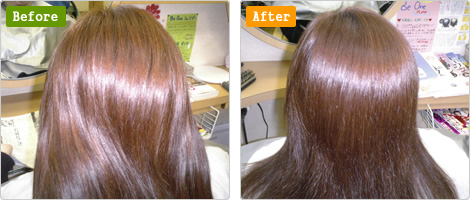 デトックス＆トリートメント体験談01