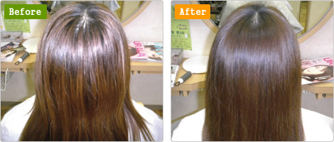 デトックス＆トリートメント体験談02